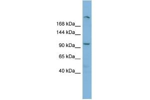 WB Suggested Anti-HERC4 Antibody Titration:  0. (HERC4 anticorps  (Middle Region))