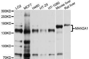 Western blot analysis of extracts of various cell lines, using MAN2A1 antibody (ABIN5998164) at 1/1000 dilution. (alpha-Mannosidase II anticorps)