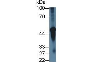Detection of CHRNa3 in Mouse Cerebellum lysate using Polyclonal Antibody to Cholinergic Receptor, Nicotinic, Alpha 3 (CHRNa3) (CHRNA3 anticorps  (AA 32-240))