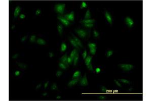 Immunofluorescence of monoclonal antibody to NR1H4 on HepG2 cell. (NR1H4 anticorps  (AA 363-472))