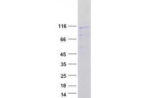 Validation with Western Blot