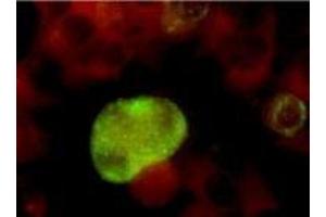 Immunofluorescence (IF) image for anti-Herpes Simplex Virus Type 2, Glycoprotein G (HSV2 gG) antibody (ABIN265564) (HSV-2 gG anticorps)