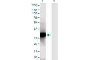 Western Blot analysis of NPM2 expression in transfected 293T cell line by NPM2 monoclonal antibody (M03), clone 5E9.