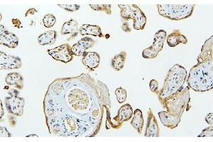 IHC analysis of MID1 using anti-MID1 antibody (ABIN6719400). (MID1 anticorps  (AA 226-278))