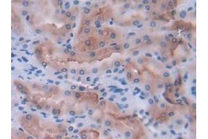 Detection of IL12A in Rat Kidney Tissue using Polyclonal Antibody to Interleukin 12A (IL12A)