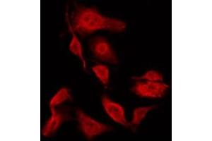 ABIN6267294 staining HeLa by IF/ICC. (HSP27 anticorps  (pSer15))