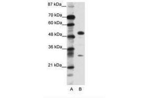 Image no. 1 for anti-Glial Cells Missing Homolog 1 (GCM1) (C-Term) antibody (ABIN6736096)