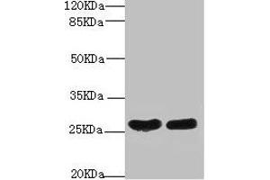 Western blot All lanes: CRP antibody at 2 μg/mL Lane 1: High values of serum at 1: 5 Lane 2: High values of serum at 1: 10 Secondary Goat polyclonal to rabbit IgG at 1/10000 dilution Predicted band size: 26, 11 kDa Observed band size: 26 kDa