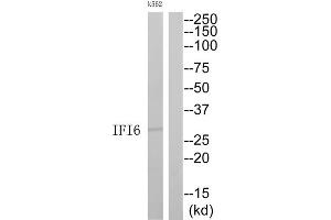 Western Blotting (WB) image for anti-Interferon, alpha-Inducible Protein 6 (IFI6) (C-Term) antibody (ABIN1852572) (IFI6 anticorps  (C-Term))