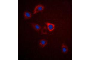 Immunofluorescent analysis of GPR75 staining in A549 cells.