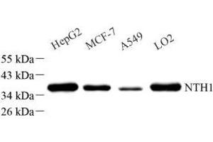 Western blot analysis of NTHL1 (ABIN7074866) at dilution of 1: 1000 (Nth Endonuclease III-Like 1 (NTHL1) anticorps)