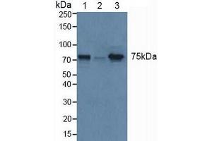 Figure. (GBA anticorps  (AA 117-214))