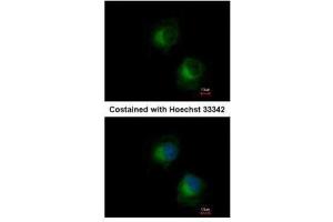 ICC/IF Image Immunofluorescence analysis of methanol-fixed HeLa, using IFIT3, antibody at 1:500 dilution. (IFIT3 anticorps)