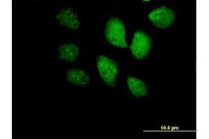 Immunofluorescence of purified MaxPab antibody to BRF1 on HeLa cell. (BRF1 anticorps  (AA 1-473))