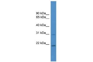 WB Suggested Anti-HOXB1 Antibody Titration:  0. (HOXB1 anticorps  (C-Term))