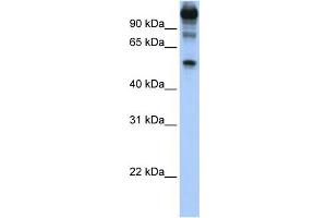 WB Suggested Anti-FEZF1 Antibody Titration:  1 ug/ml  Positive Control:  Hela cell lysate (FEZF1 anticorps  (C-Term))