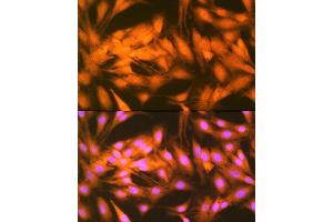 Immunofluorescence analysis of C6 cells using FGF1 Rabbit mAb (ABIN7267182) at dilution of 1:100 (40x lens).