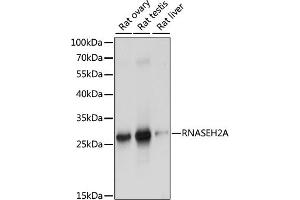 Western blot analysis of extracts of various cell lines, using RNA antibody (ABIN7269981) at 1:1000 dilution. (RNASEH2A anticorps  (AA 1-299))
