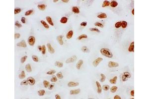 ICC testing of Splicing factor 1 antibody and HeLa cells (Splicing Factor 1 anticorps  (N-Term))