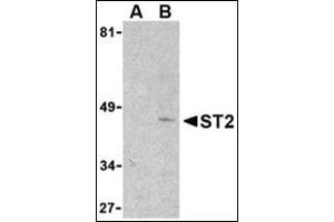 Western blot analysis of ST2 in mouse kidney lysate with this product at 1 μg/ml in the presence (lane A) or absence (lane B) of 1 μg blocking peptide. (IL1RL1 anticorps  (N-Term))
