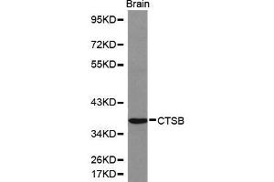 Western Blotting (WB) image for anti-Cathepsin B (CTSB) (AA 1-339) antibody (ABIN6214050) (Cathepsin B anticorps  (AA 1-339))