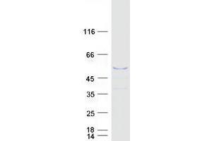 Validation with Western Blot
