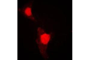 Immunofluorescent analysis of FOXO1 (pS319) staining in HeLa cells.