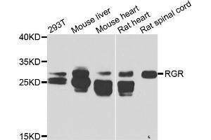 Western blot analysis of extracts of various cell lines, using RGR antibody (ABIN5975227) at 1/1000 dilution. (RGR anticorps)