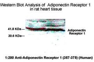 Western Blot Analysis of Adiponecitin Receptor 1 in rat heart tissue. (Adiponectin Receptor 1 anticorps  (AA 357-375))