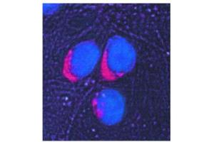 Image no. 3 for anti-Glucose-6-Phosphate Isomerase (GPI) antibody (ABIN347737) (GPI anticorps)