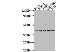Western Blot Positive WB detected in: Hela whole cell lysate, MCF-7 whole cell lysate, A549 whole cell lysate, COLO205 whole cell lysate, PC-3 whole cell lysate All lanes: LPAR2 antibody at 1:2000 Secondary Goat polyclonal to rabbit IgG at 1/50000 dilution Predicted band size: 40 kDa Observed band size: 40 kDa (EDG4 anticorps  (AA 8-27))