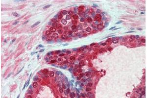 Human Prostate: Formalin-Fixed, Paraffin-Embedded (FFPE)