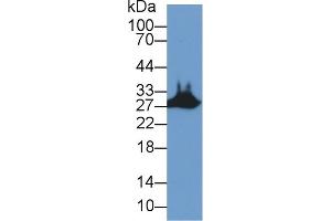 Detection of STC2 in Mouse Skeletal muscle lysate using Polyclonal Antibody to Stanniocalcin 2 (STC2) (Stanniocalcin 2 anticorps  (AA 53-294))