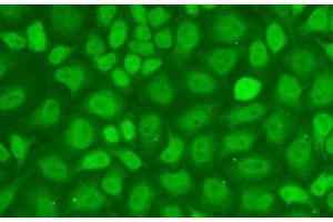 Immunofluorescence analysis of A-549 cells using CXXC1 Polyclonal Antibody (CXXC1 anticorps)