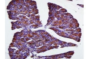 Paraformaldehyde-fixed, paraffin embedded Rat Pancreas tissue, Antigen retrieval by boiling in sodium citrate buffer(pH6) for 15min, Block endogenous peroxidase by 3% hydrogen peroxide for 20 minutes, Blocking buffer (normal goat serum) at 37°C for 30min, Antibody incubation with FAM134B Polyclonal Antibody, Unconjugated  at 1:400 overnight at 4°C, followed by a conjugated secondary and DAB staining