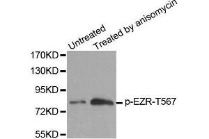 Western blot analysis of extracts from MDA cells, using Phospho-EZR-T567 antibody. (Ezrin anticorps  (pThr567))