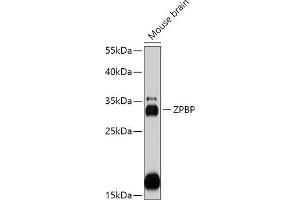 Western blot analysis of extracts of Mouse brain, using ZPBP antibody (ABIN7271569) at 1:1000 dilution. (ZPBP anticorps  (AA 45-200))