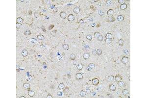 Immunohistochemistry of paraffin-embedded Rat brain using BEST1 Polyclonal Antibody at dilution of 1:100 (40x lens). (Bestrophin 1 anticorps)