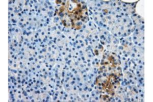 Immunohistochemical staining of paraffin-embedded liver tissue using anti-AKR1A1mouse monoclonal antibody. (AKR1A1 anticorps)