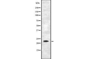 Western blot analysis of AK5 using Jurkat whole cell lysates (Adenylate Kinase 5 anticorps  (N-Term))