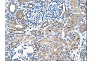 Image no. 1 for anti-Sarcosine Dehydrogenase (SARDH) (AA 94-143) antibody (ABIN320712)