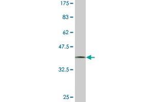 Western Blot detection against Immunogen (36. (UNC13D anticorps  (AA 2-100))