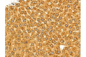 ABIN6258287 and ABIN6275230 at 1/100 staining Rat liver tissue by IHC-P.