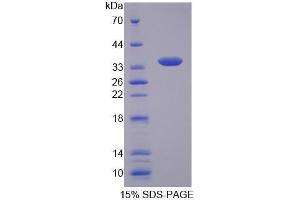 Image no. 1 for Solute Carrier Family 25 (Mitochondrial Carrier, Citrate Transporter), Member 1 (Slc25a1) (AA 19-311) protein (His tag) (ABIN6239633)