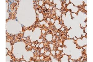 ABIN6267525 at 1/200 staining Mouse lung tissue sections by IHC-P.