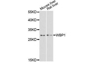 Western blot analysis of extracts of various cell lines, using WBP1 antibody (ABIN6291069) at 1:3000 dilution.