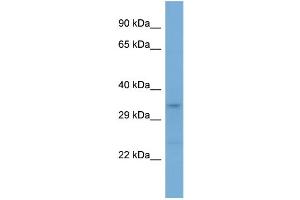 Western Blotting (WB) image for anti-Leucine Rich Repeat Containing 17 (LRRC17) (Middle Region) antibody (ABIN2784657) (LRRC17 anticorps  (Middle Region))