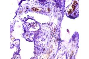 Immunohistochemistry of paraffin-embedded human placenta tissue using ABIN7157091 at dilution of 1:50 (ICA1 anticorps  (AA 1-268))