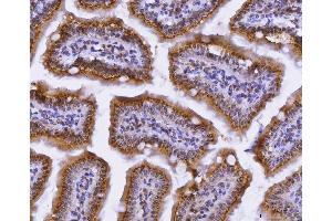 IHC analysis of CUX1 using anti-CUX1 antibody (ABIN7599103).