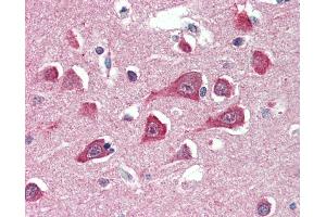 Anti-PLA2G16 antibody IHC of human brain, cortex. (PLA2G16 anticorps  (AA 2-15))